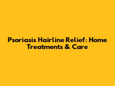 Psoriasis Hairline Relief: Home Treatments & Care